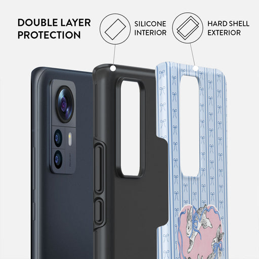 Follow Me - Xiaomi 12 Case 2