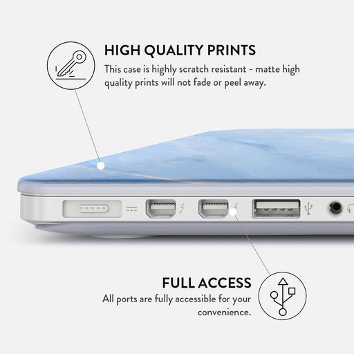 Fluffy Clouds - Macbook Case