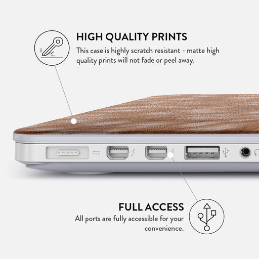 Country Road - Macbook Case
