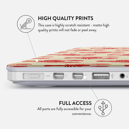 Chef's Kiss - Macbook Case