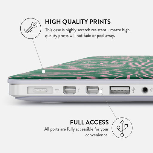 Hawaiian Breeze - Macbook Case