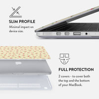 Sundress - Macbook Case