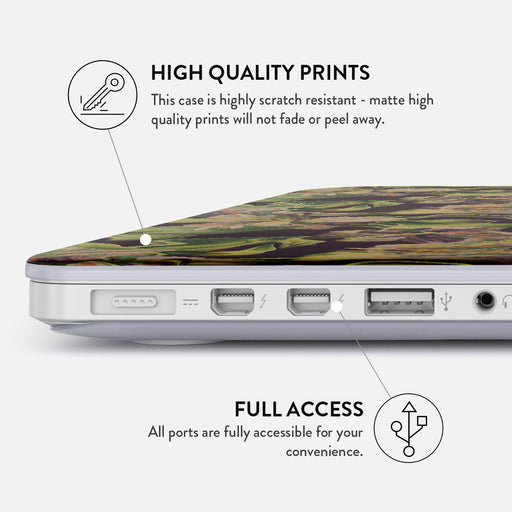 Subtropical - Macbook Case