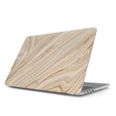 Full Glam - Macbook Case