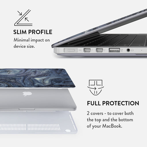 Navy Trench - Macbook Case