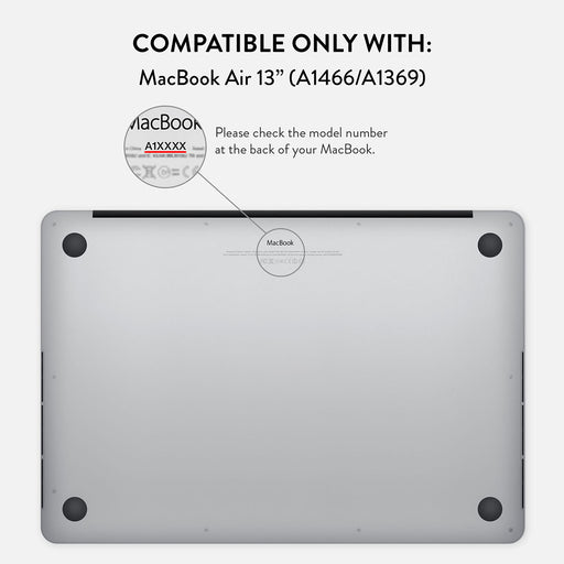 Beach Please - Macbook Case