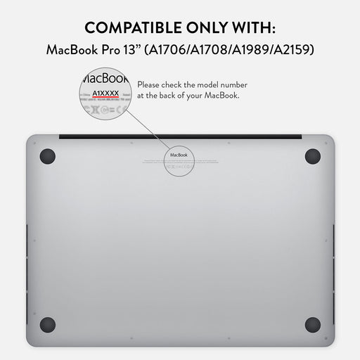 Sorry Busy - Macbook Case