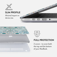Tropical Oasis - Macbook Case