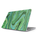 Rock On - Macbook Case