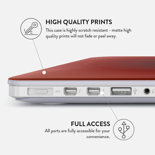 No Talking - Macbook Case