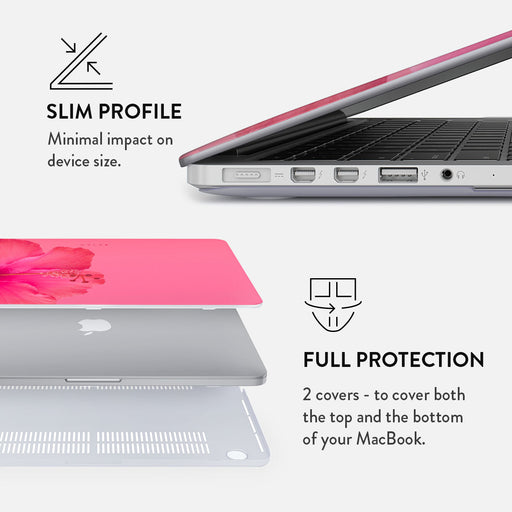 Island Girl - Macbook Case