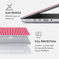 Favorite Bikini - Macbook Case