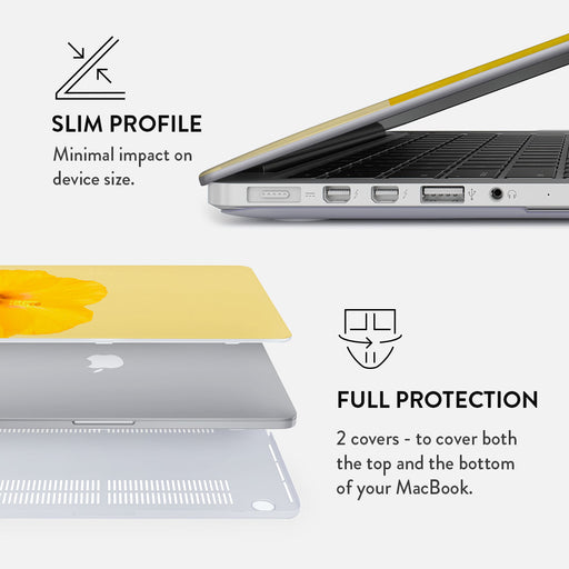 Hibiscus - Macbook Case