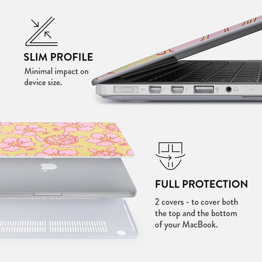 Tan Break - Macbook Case