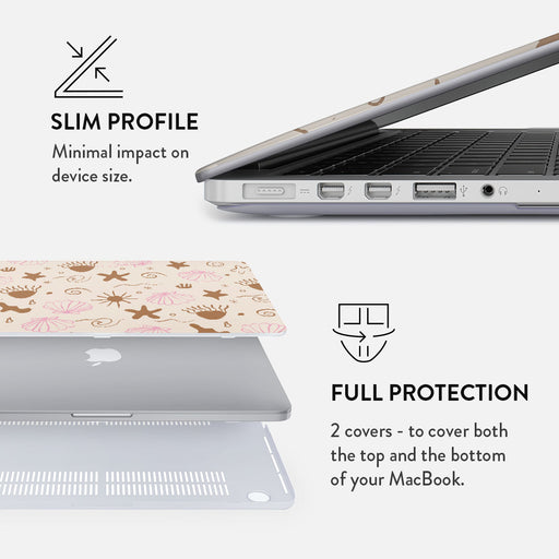 Beach Games - Macbook Case