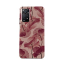 Tender Kiss - Xiaomi Redmi Note 11 Pro+ Case