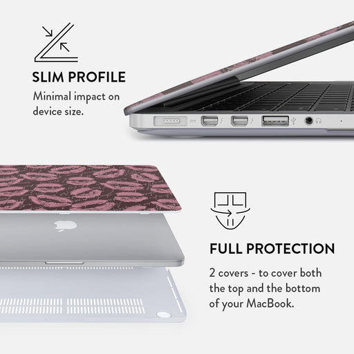 Melodrama - Macbook Case