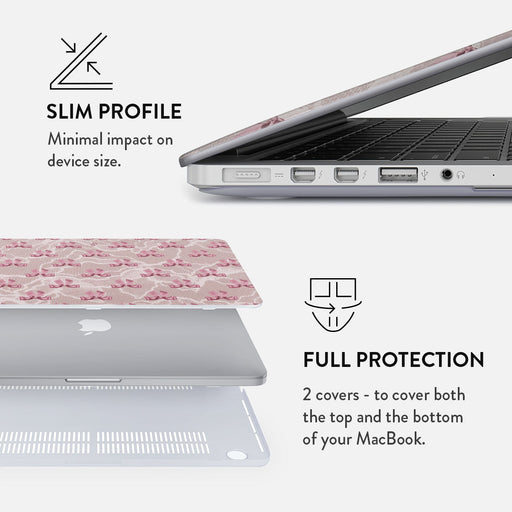 Ballerina - Macbook Case 18