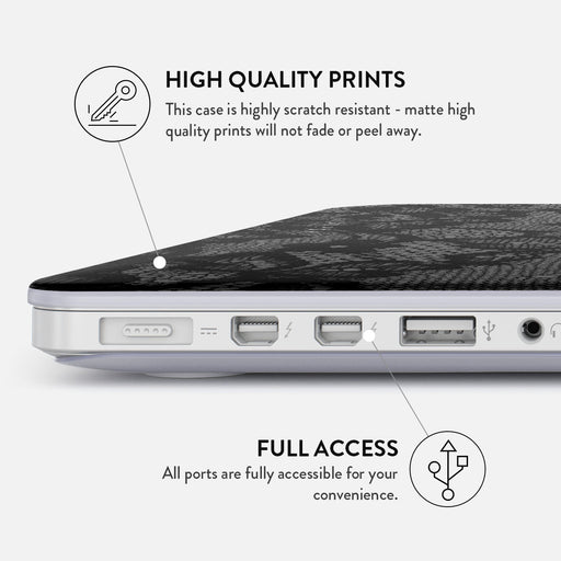 Magnetic - Macbook Case