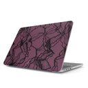 That Girl - Macbook Case 1