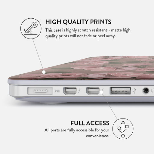 Vintage Glamour - Macbook Case