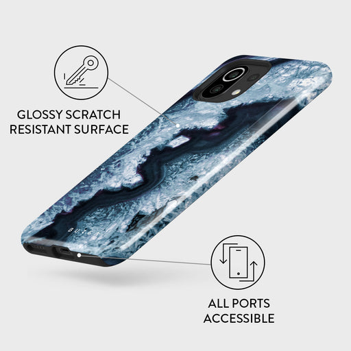 Frozen Lake - Gray Marble Xiaomi Mi 11 Lite 4G / 5G Case